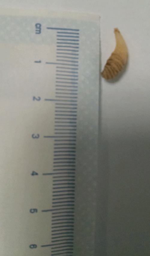 Image 2. Botfly extracted from right infra-orbital lesion.