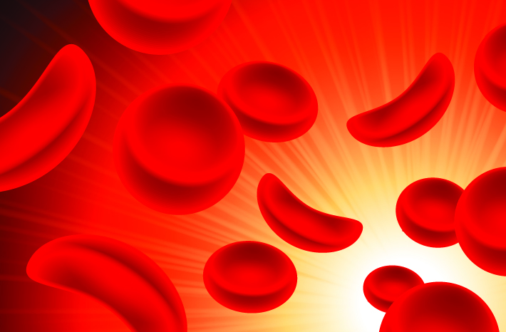 Sickle-Cell.jpg