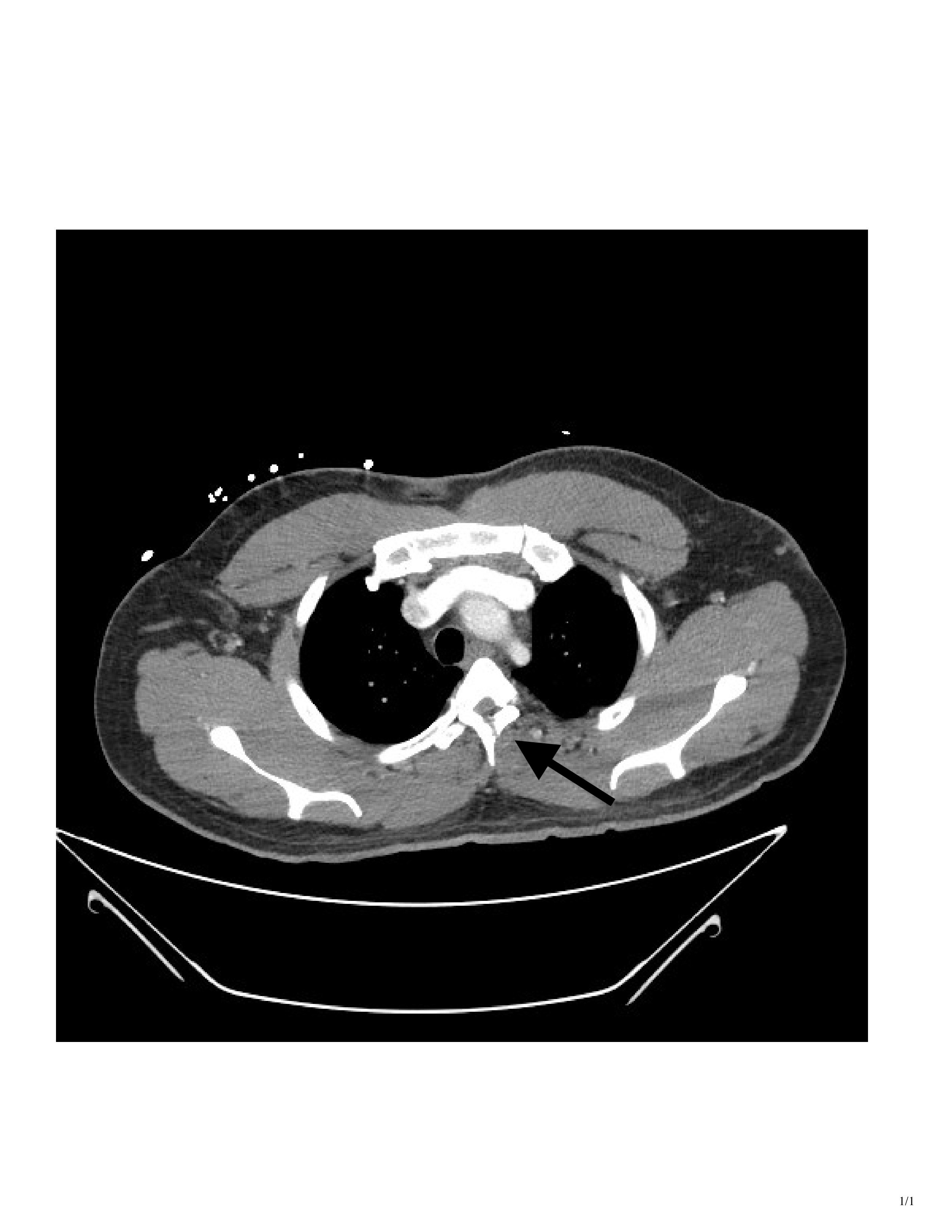 CT Axial.jpg