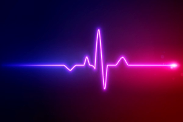 EKG photo.jpg