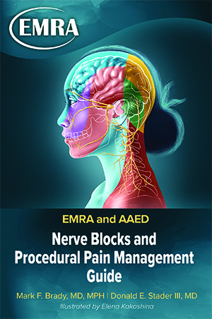 2023_Nerve Block Guide.jpg