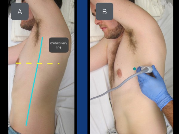 16 - US Guided Nerve Blocks - 005.jpeg