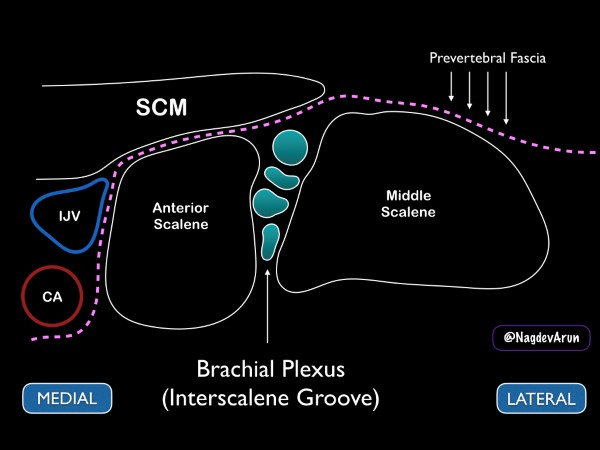 16 - US Guided Nerve Blocks - 008.jpeg