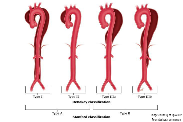 45-2_Aortic Dissection.jpg