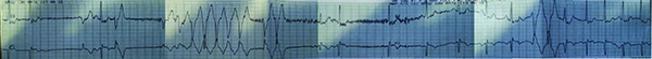 47-2 NSVT - Figure 2 REPLACEMENT_web.jpg