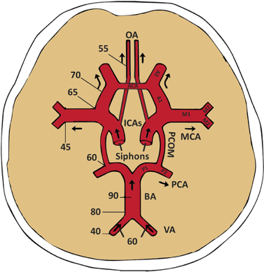 Transcranial Doppler - Figure 1A.jpg