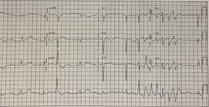 47-6 ECG Challenge - Dec-Jan2020.jpg