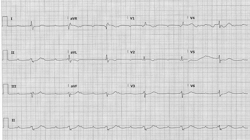 48-2 ECG Challenge.jpg