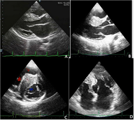 48-2 HOCM - Figure 5.png