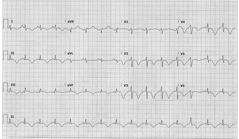 48-3 ECG Challenge initial.jpg