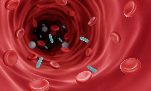Sepsis Anchor Art.jpg