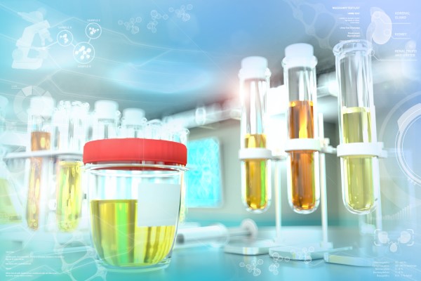 Urine Drug Screen Anchor Art.jpg