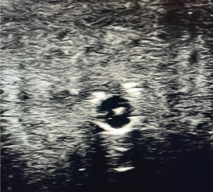 POCUS Figure 4.jpg