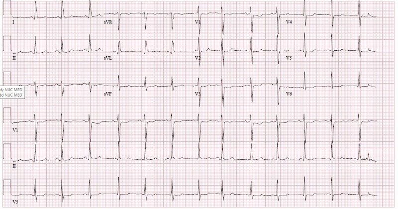 Cardiac Arrest Figure 1.jpg