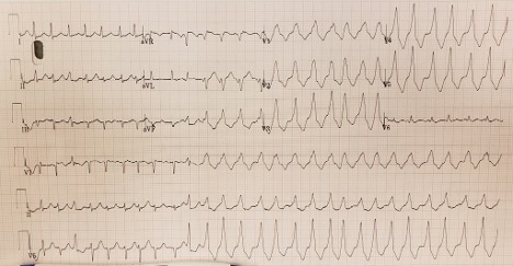 101425-ECG2.jpg