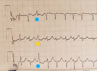 101425-ECG3.jpg