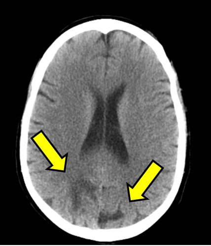 Figure 1A