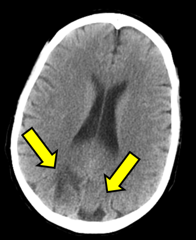 Figure 1B