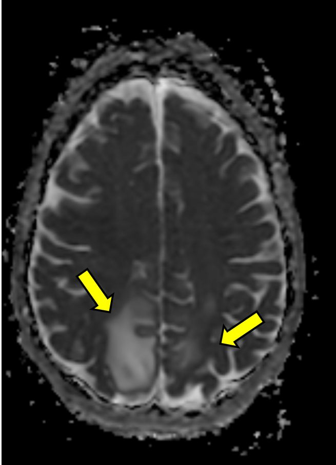Figure 1C