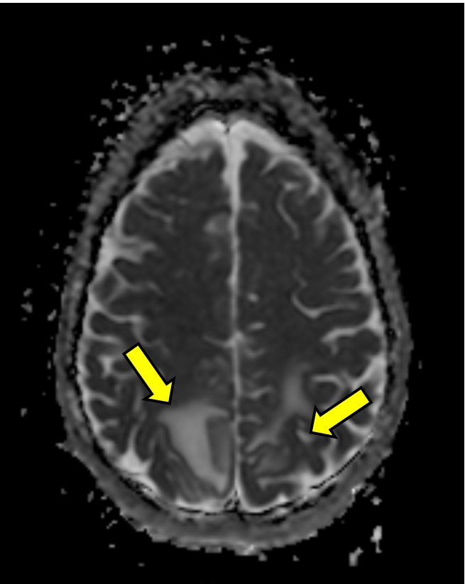Figure 1D