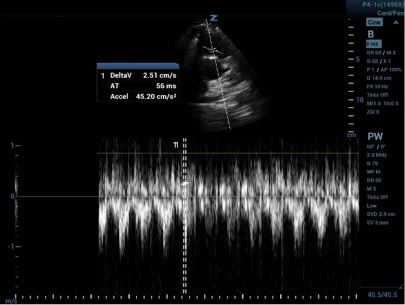 CCUS 60-60 Fig 3a.jpg